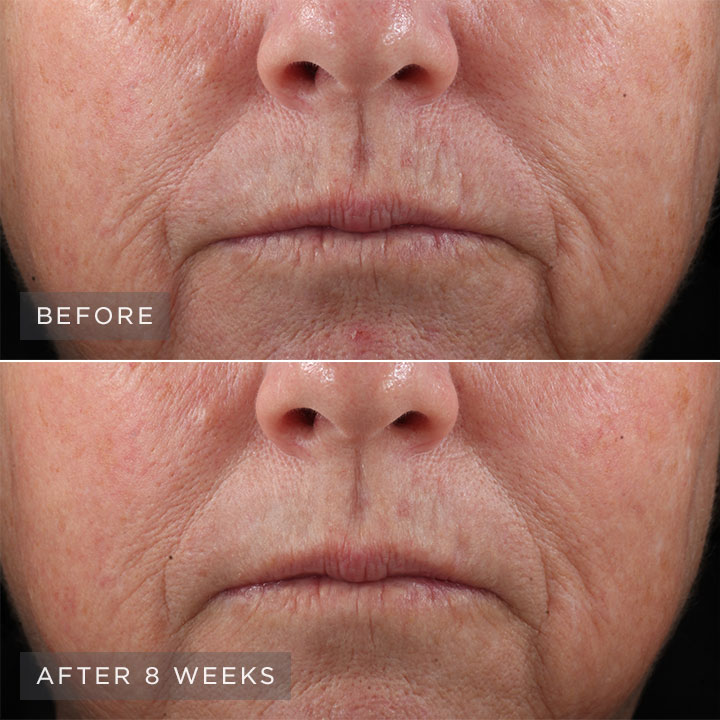 Before and after images. Before and after images.