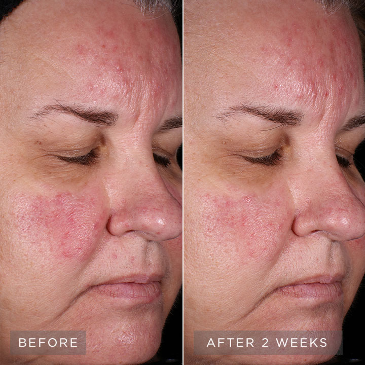Before and after images. Before and after images.