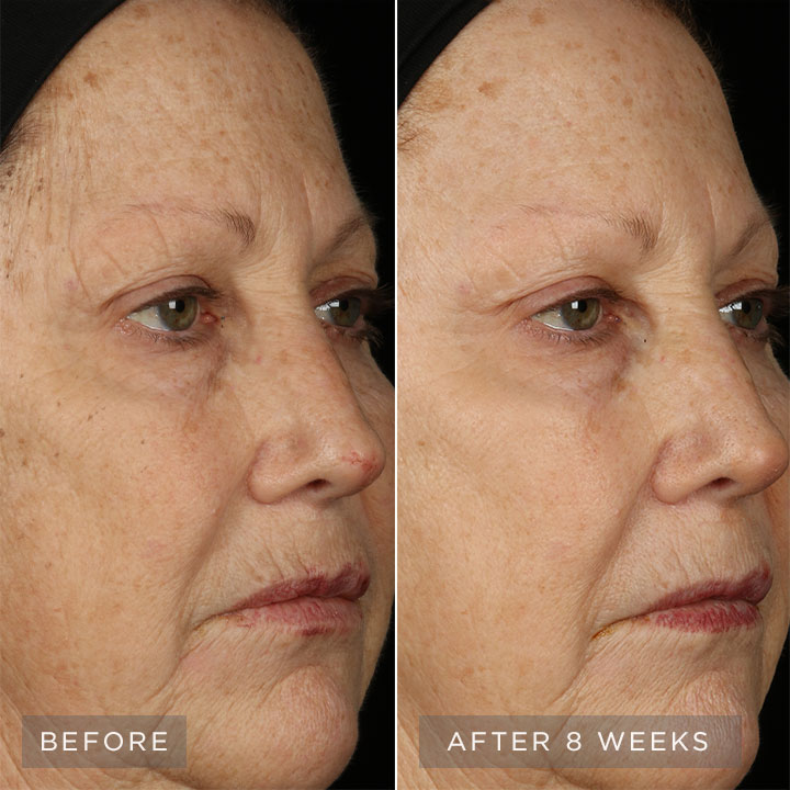 Before and after images. Before and after images.
