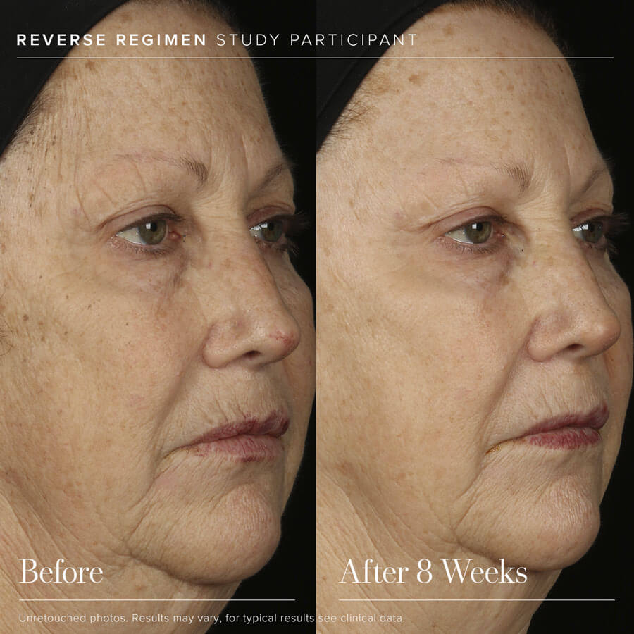 REVERSE Tone Correcting Treatment