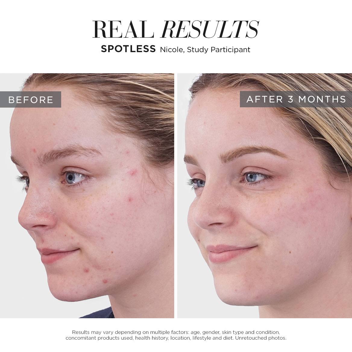 SPOTLESS Regimen