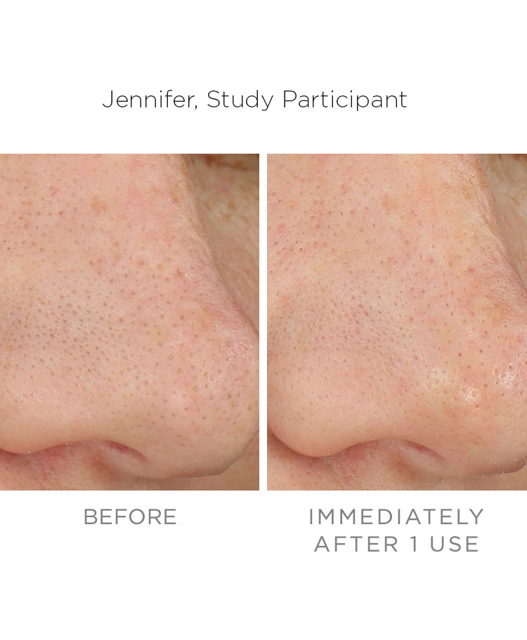 https://www.rodanandfields.com.au/medias/real-results-pore-tool-fullwidthbanner-1-m.jpg?context=bWFzdGVyfGltYWdlc3w4Mjk0OXxpbWFnZS9qcGVnfGFXMWhaMlZ6TDJneFpTOW9OVFl2T0RjNU9EZ3lORGsxTlRrek5DNXFjR2N8MTg5NmM3NTk0MWRiNzhiMGM0NTk0MzMzODUyY2MxOGRhOTc4NmU5NjA0NTk2YmY2NDUzMTc2MzcxZWFhNTg0Nw
