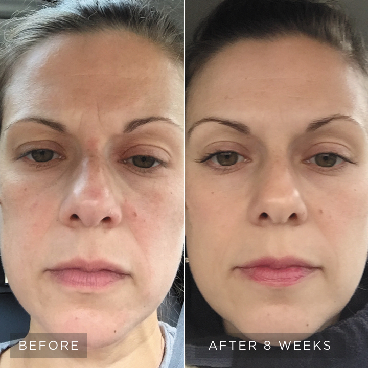 skincare-philosophy-visible-results-4-vertical-image-lockup-fine-lines-left-d.jpg skincare-philosophy-visible-results-4-vertical-image-lockup-fine-lines-left-d.jpg