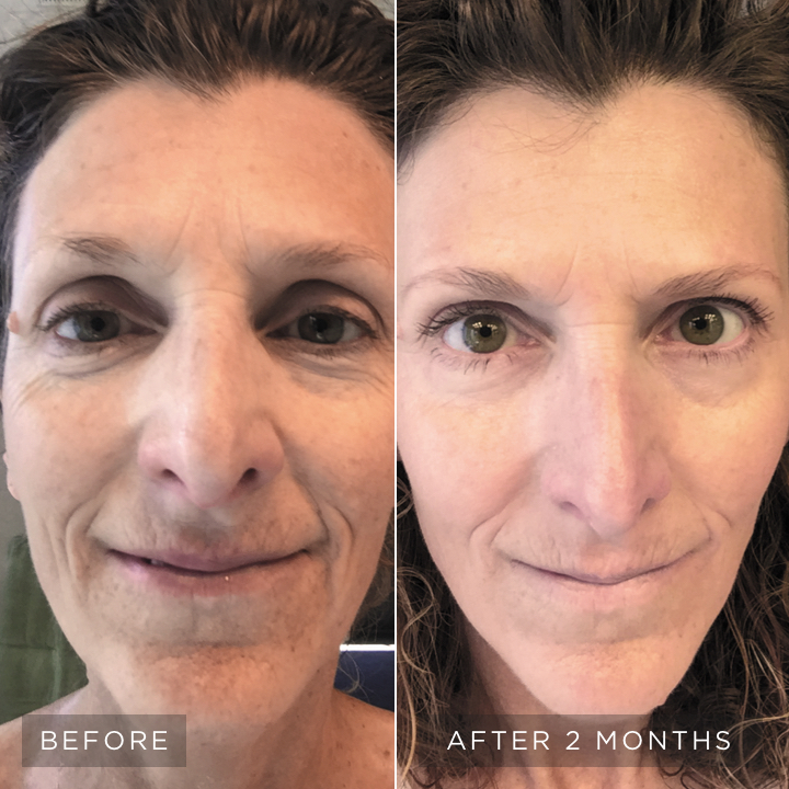 skincare-philosophy-visible-results-4-vertical-image-lockup-lifting-firming-center-d.jpg skincare-philosophy-visible-results-4-vertical-image-lockup-lifting-firming-center-d.jpg