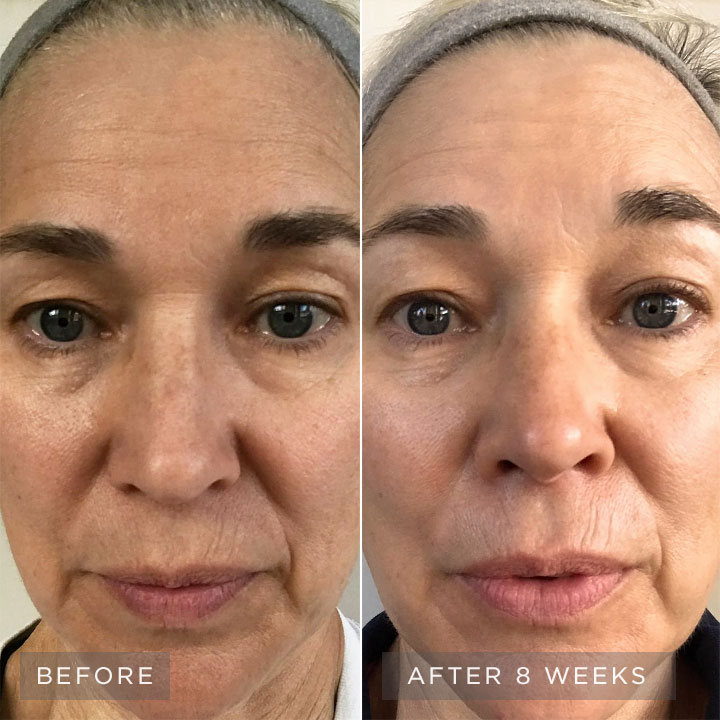 Before and after images. Before and after images.