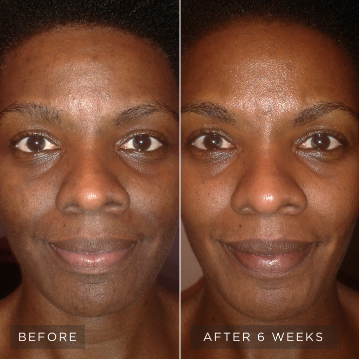 skincare-philosophy-visible-results-4-vertical-image-lockup-uneven-skin-right-d.jpg skincare-philosophy-visible-results-4-vertical-image-lockup-uneven-skin-right-d.jpg